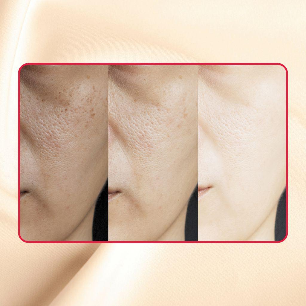 Thick As Thieves Pure Glycolic Acid Lactic Acid Extreme Gel Peel - 50ml