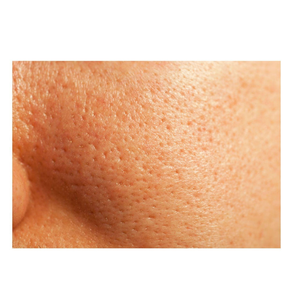 Thick As Thieves Pure Glycolic Acid Lactic Acid Extreme Gel Peel - 50ml