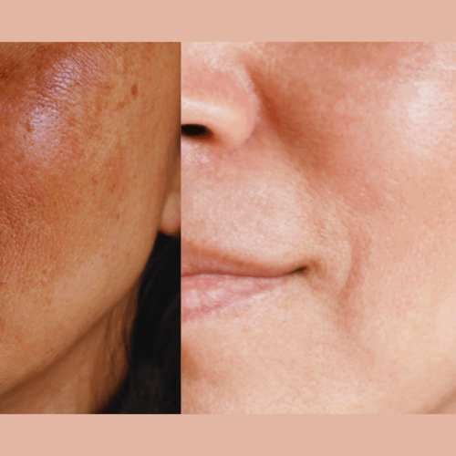 Ultra-Advanced Anti-Aging Daily Resurfacing Pads