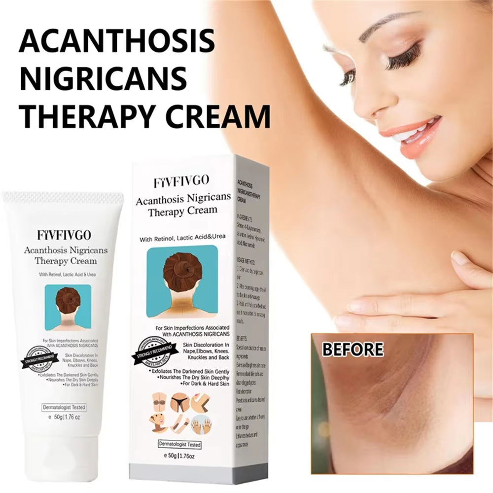 Underarm Creams for Dark Skin Body Crotch Armpit Moisturizing Korean Skincare Products 50G
