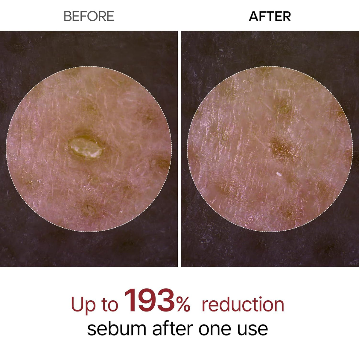 Dr. Melaxin Peel Shot Exfoliant Black Rice Ampoule