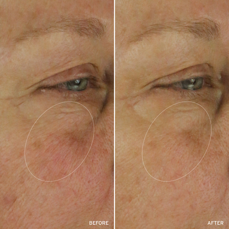 NAD+ CELL ENERGIZING TREATMENT