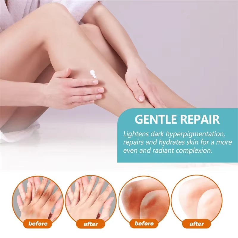 Underarm Creams for Dark Skin Body Crotch Armpit Moisturizing Korean Skincare Products 50G