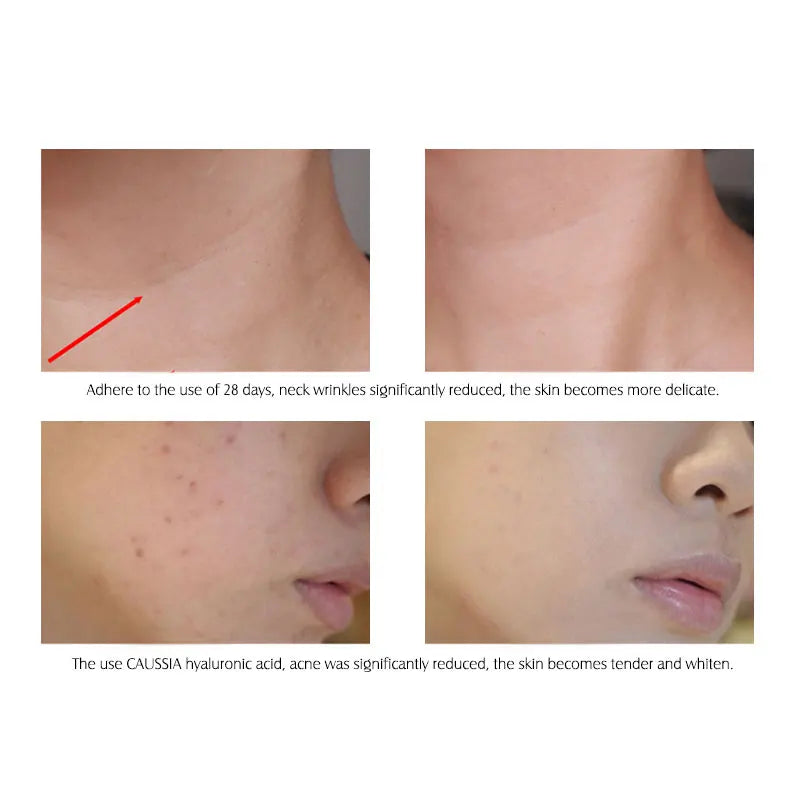 Hyaluronic Acid Hydrating Serum