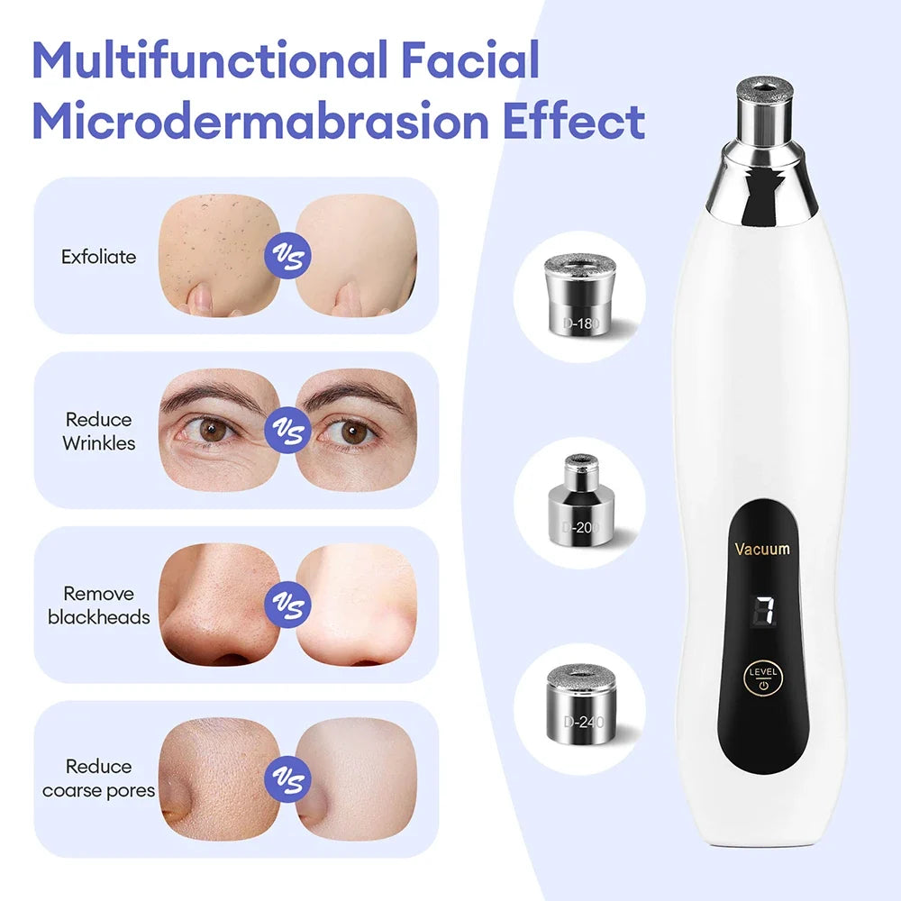 Diamond Microdermabrasion Resurfacing System
