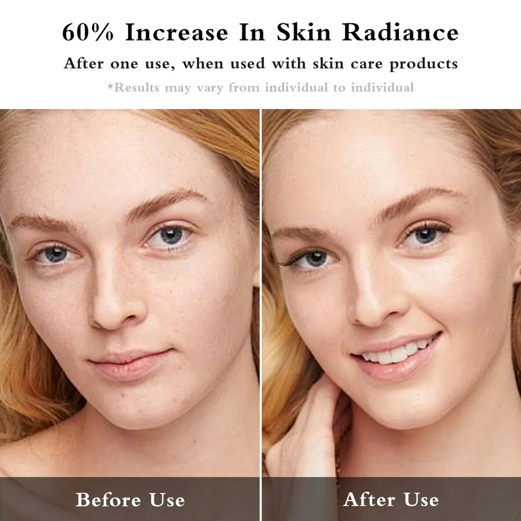 Facial EMS + IPL Skin Rejuvenation Beauty Device
