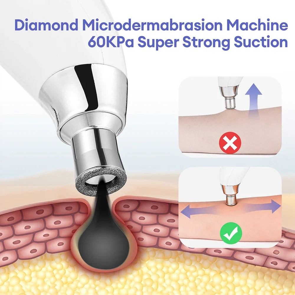 Diamond Microdermabrasion Resurfacing System