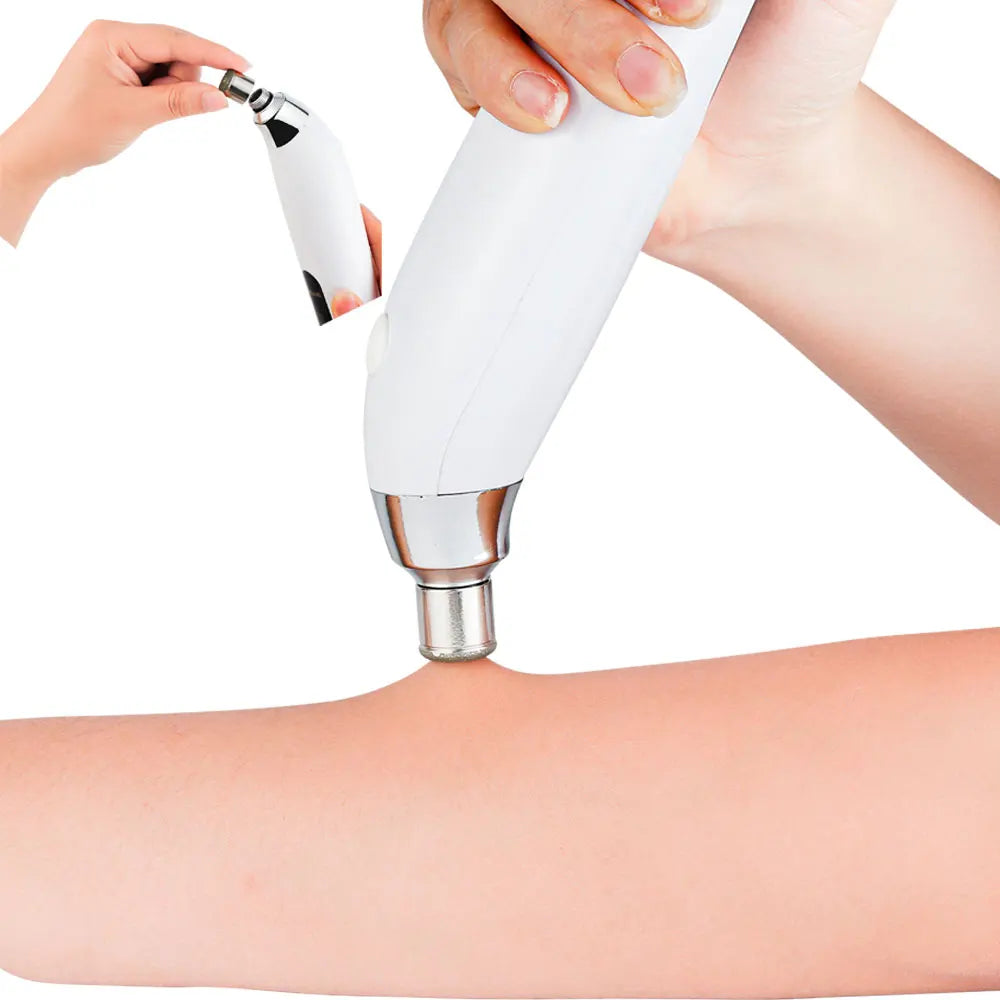 Diamond Microdermabrasion Resurfacing System
