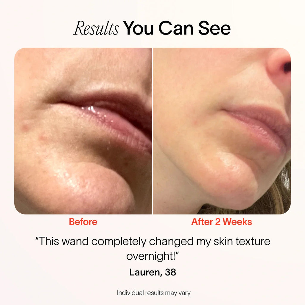 4-In-1 Radiant Renewal Skincare Wand with Red Light Therapy