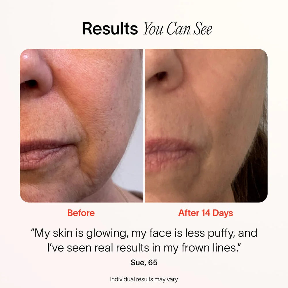 4-In-1 Radiant Renewal Skincare Wand with Red Light Therapy