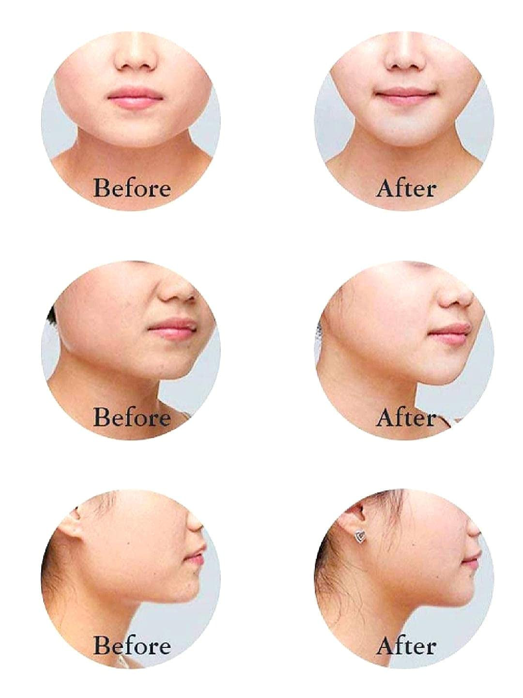 SLIM FACE SLIMMING BAND FACIAL BELT DOUBLE CHIN REDUCER V LINE FACE LIFT anti SNORE WRINKLE FACE BANDAGE DOUBLE CHIN STRAP SAGGING FACE CONTOUR JAWLINE TIGHTEN STRAP 1PK