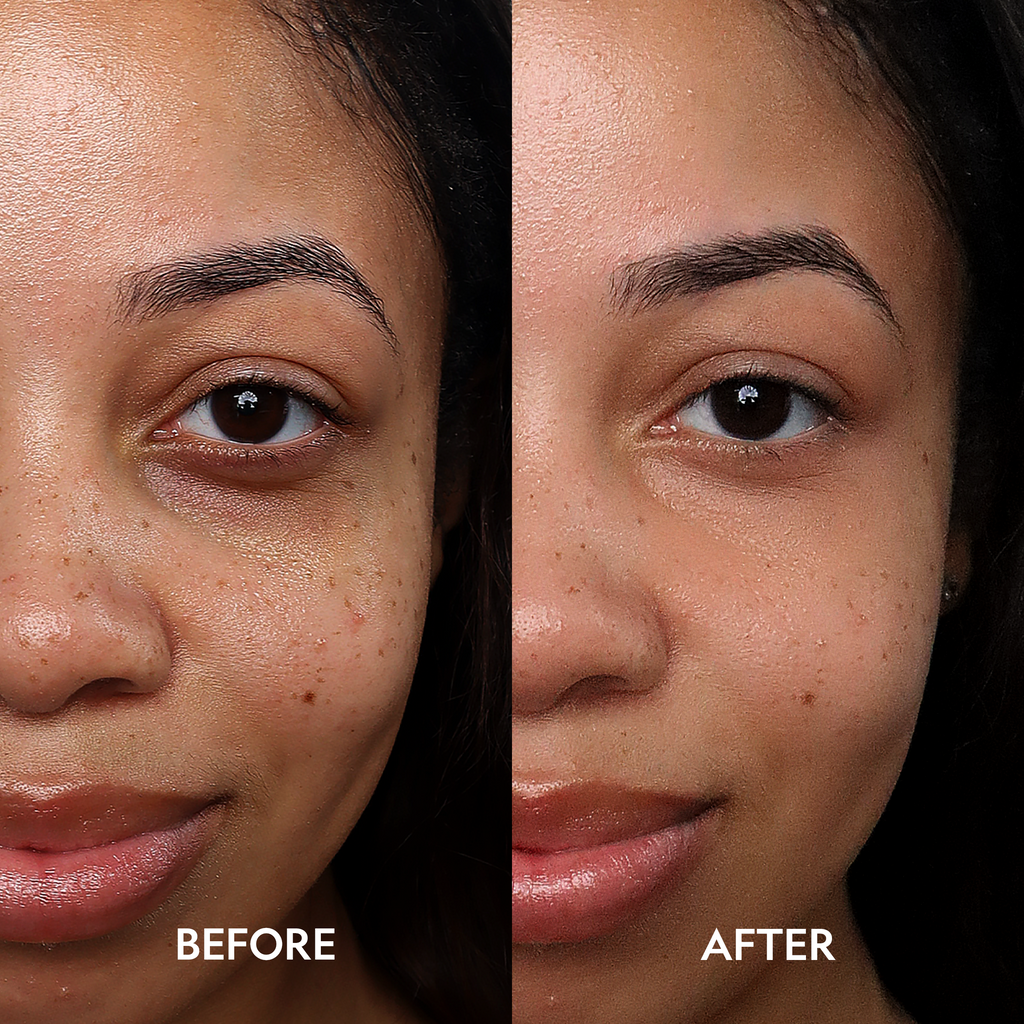 Super Bright Dark Circle Serum Peptide Corrector